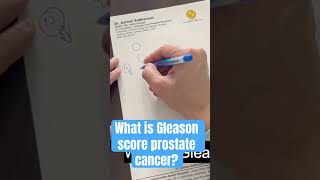 Understanding Gleason score Prostate cancer [upl. by Voltz639]