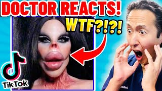 Plastic Surgeon Reacts to BOTCHED Plastic Surgery TikTok Videos [upl. by Relyc]