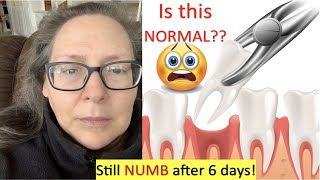 NERVE DAMAGE AFTER TOOTH EXTRACTIONS AND IMPLANTS  LINGERING FACIAL NUMBNESS AFTER DENTAL SURGERY 😬 [upl. by Aiuqes]