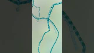 🤖 Spirogyra Conjugación bajo el microscopio 🤖 🔬 [upl. by Nyasuh]