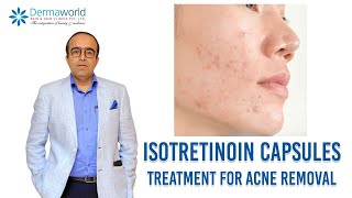 Isotretinoin capsules  Treatment for Acne removal  In Hindi  Dr Rohit Batra [upl. by Lindo569]