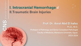 Intracranial hemorrhage and traumatic brain injury  شرح محاضرة [upl. by Adnolaj]