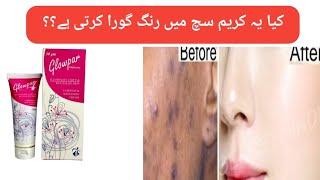 Glowpar whitening Cream Review  Medicated cream worth buying [upl. by Fazeli117]