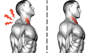 Fix Neck Pain Relief and Neck Hump [upl. by Noam]