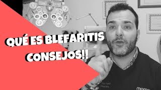 BlefaritisConoce Qué Ocurre En Tus Ojos  CONSEJOS [upl. by Mcgean]