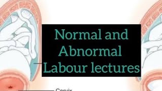 Normal and abnormal labor lectures part 7 Management of labor  Detail explanation obslectures [upl. by Warrick]