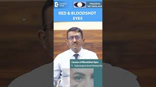 5 Common Causes of Red Eyes What Your Eyes Are Trying to Tell You italk eyeinflammation [upl. by Ainitsirhc]