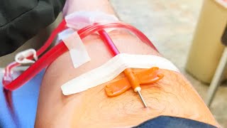 What Does It Feel Like to Donate Plasma Answering Frequently Asked Questions About Donating Plasma [upl. by Scully]