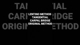 Lentino MethodGaynor Hart MethodMarshall Method Superioinferior Projection [upl. by Daniell]