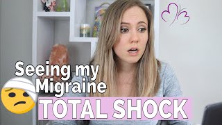 The Reality of Migraine RAW FOOTAGE amp my Real Reaction to Seeing a Migraine for the First Time [upl. by Heisel]