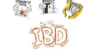 Inflammatory Bowel Disease IBD [upl. by Evered]