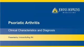 Psoriatic Arthritis  Clinical Characteristics and Diagnosis [upl. by Byrne]