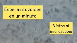 Espermatozoides al microscopio aumentados 400 veces [upl. by Estrellita]