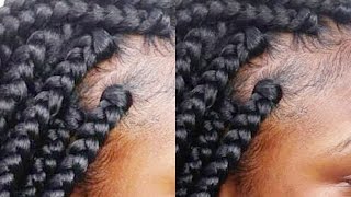 Tips and Tricks Gripping The Roots Rubber Band MethodBox Braid Like A Pro part 4 [upl. by Herriott373]