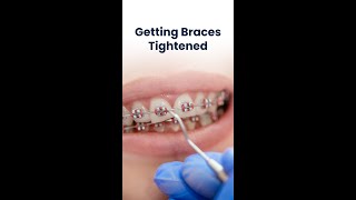 Whats the process of getting your braces tightened [upl. by Hans]