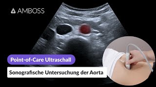 PointofCareUltraschall Teil 14 Sonografische Untersuchung der Aorta  AMBOSS [upl. by Kassaraba]