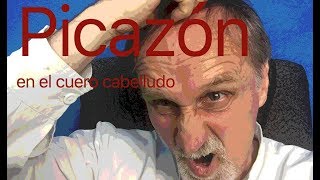 PICAZON en el cuero cabelludo [upl. by Cass248]