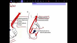 Talipes calcaneovalgus [upl. by Defant]