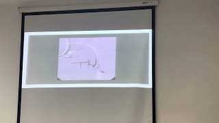 11167 Salivary gland disorder  soft tissue opacities  ไม่ได้ถ่ายบท TMJ abnormalities [upl. by Moreville257]