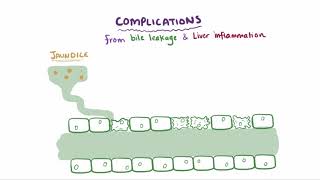 Primary biliary cholangitis causes symptoms diagnosis treatment amp pathology [upl. by Arateehc]