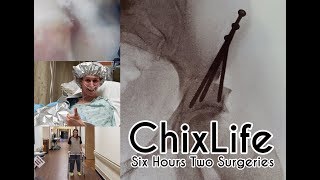 ChixLife Lets Cut Your Pelvis in 3 Places [upl. by Nesnaj]