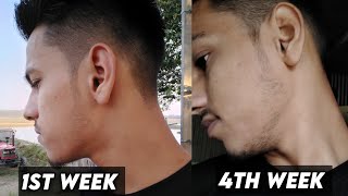 1 Month Use Minoxidil Beard Transformation  1 Month Results Minoxidil [upl. by Elyk]