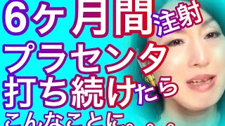 【元男子激白】半年間プラセンタ注射を打ち続けて体に起きた異変を告白。。。 [upl. by Ahsatan]