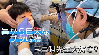 【病院】鼻の奥から巨大ブツ収穫4cm以上奥を華麗な診察【耳鼻科】 [upl. by Asyl]