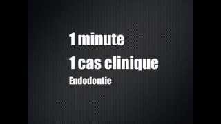 Une minute un cas clinique  Episode 1  Endodontie [upl. by Danby]