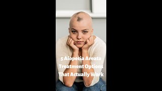 5 Alopecia Areata Treatment Options that Actually Work shorts [upl. by Ettelocin602]