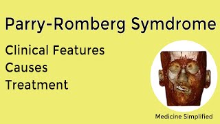 Parry Romberg Syndrome  Causes Symptoms Treatment and Clinical Features [upl. by Libb]