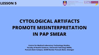 Cytological Artifacts Promote Misinterpretation in Pap Smear [upl. by Cand382]