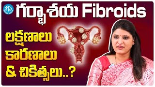 Uterine Fibroids Symptoms Causes and Treatments  Dr Poornima Durga  MOM IVF  iDream Media [upl. by Etak]