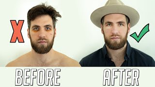 How to Get Rid of Dark Circles and Pimples  Mens Skincare 2020 [upl. by Schumer]