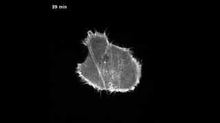 Actin dynamic during cell division [upl. by Airdnax]