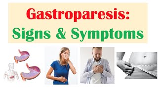 Gastroparesis Signs amp Symptoms ex Nausea Abdominal Pain Weight Loss [upl. by Kcirddet]