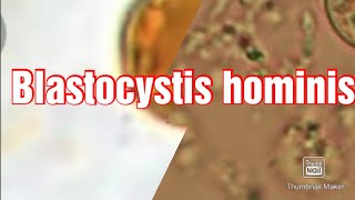 Skill Lab12 Blastocystis hominis [upl. by Eux]