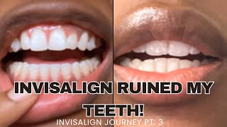 INVISALIGN JOURNEY PART 3  INVISALIGN RUINED MY TETTH [upl. by Adnilemre]