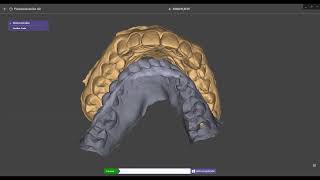 BiteFinder 31 Tramuntana Exocad Integration Intro From juancarlospalma DentalCADAcademy Spain [upl. by Wilscam]