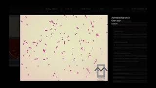 Actinobacillus ureae  Microbiology [upl. by Ggerk337]