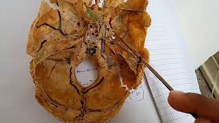 CONTENTS of pterygopalatine fossa PTERYGOPALATINE GANGLION simple explanation part 2 [upl. by Cuttie]