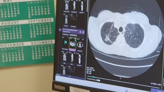 Using TILs Therapy to Fight Lung Cancer [upl. by Nednarb]