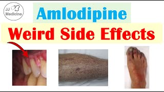 Amlodipine Weird Side Effects Skin Gastrointestinal Psychological [upl. by Bokaj]