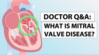 Mitral Valve Disease Awareness What Is Mitral Valve Disease [upl. by Landry]