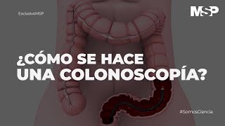 ¿Cómo se hace una colonoscopía ExclusivoMSP [upl. by Neysa542]