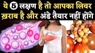 ये 5 लक्षण है तो आपका लिवर ख़राब है और अंडे तैयार नहीं होंगे  Liver Problem and Fertility in Hindi [upl. by Elbas337]