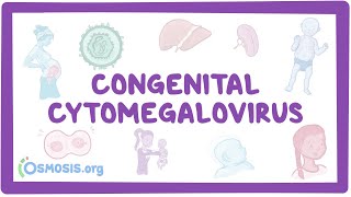 Congenital CMV  causes symptoms diagnosis treatment pathology [upl. by Donahue]