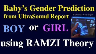 Baby boy symptoms during pregnancy from Ultrasound Report using Ramzi Theory in English [upl. by Anauqaj]