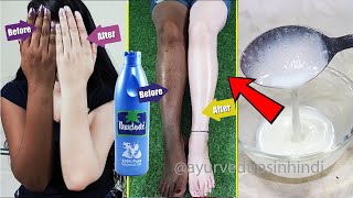 यह नुस्खा काले हाथ पैरों को दूध जैसा गोरा सॉफ्ट व चमकदार बनाया  Hand amp Foot Skin Whitening Cream [upl. by Anirdnajela]