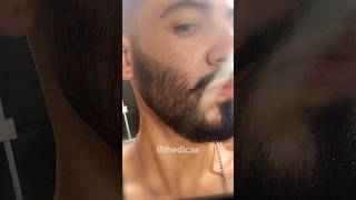 1 ANO USANDO MINOXIDIL evolução minoxidil minoxidil barba [upl. by Enyawd]